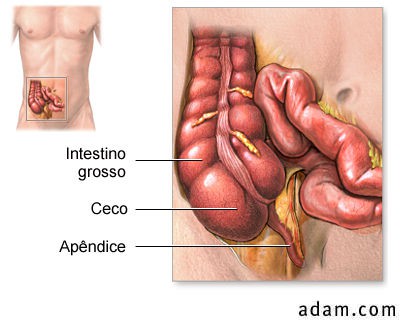 Apendicectomia